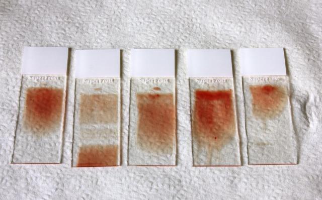 Blood smear slides of perfect and undesirable examples.