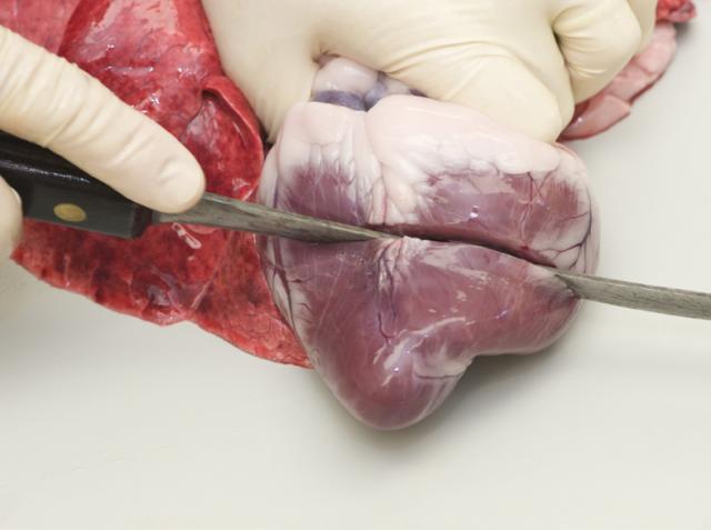 Dissecting the heart
