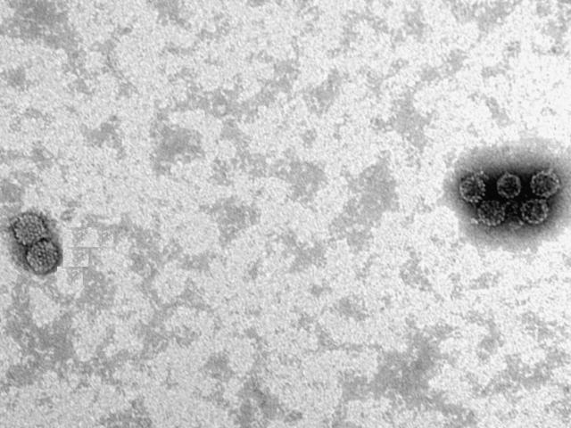 Electron microscopy bovine papillomavirus particles