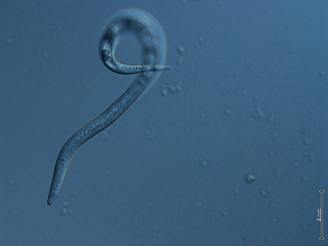 Microscopic photograph of a juvenile root-knot nematode about 0.6mm long
