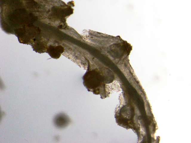 Female root-knot nematodes grow with plant roots and appear pear-shaped in photographs