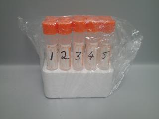 Blood tubes labelled one to five in foam rack