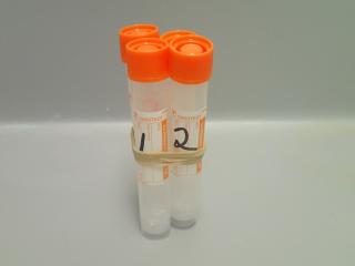 three blood tubes labelled and secured together with elastic band