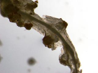 Brown coloured nematode under the microscope.