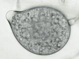 Sporangium of Phytophthora